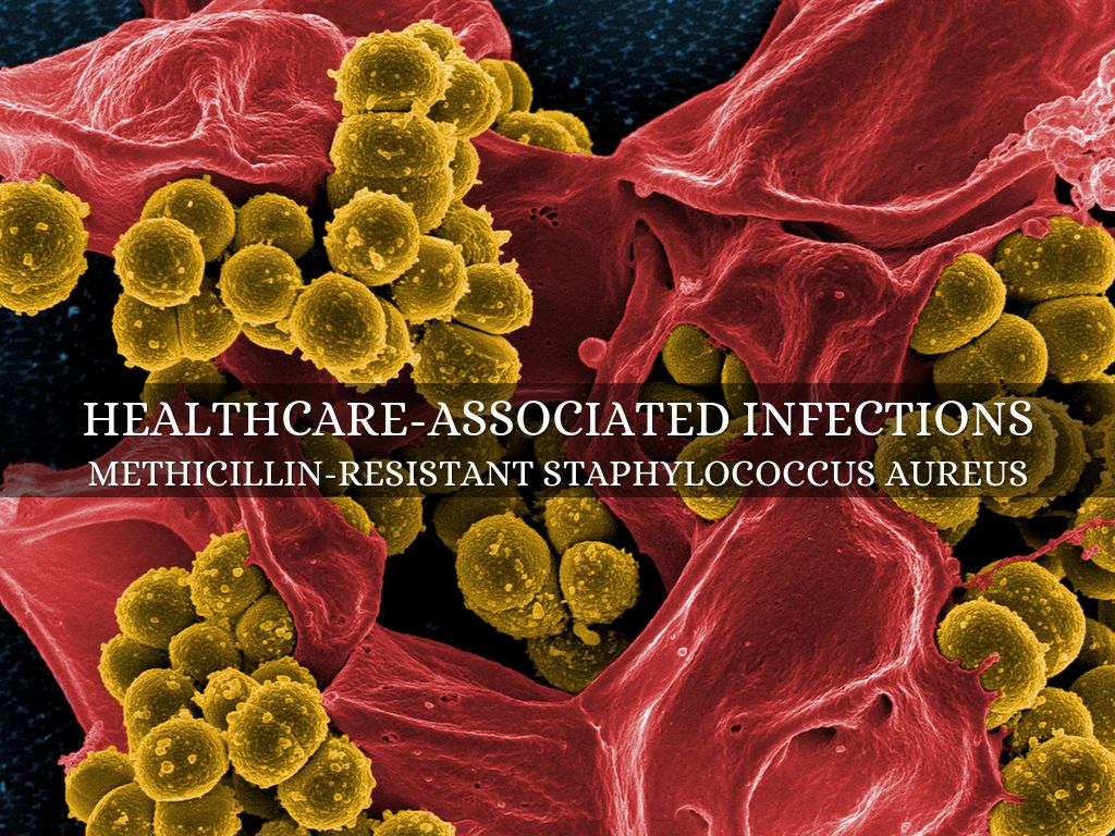 MRSA by Kimberly Lizama