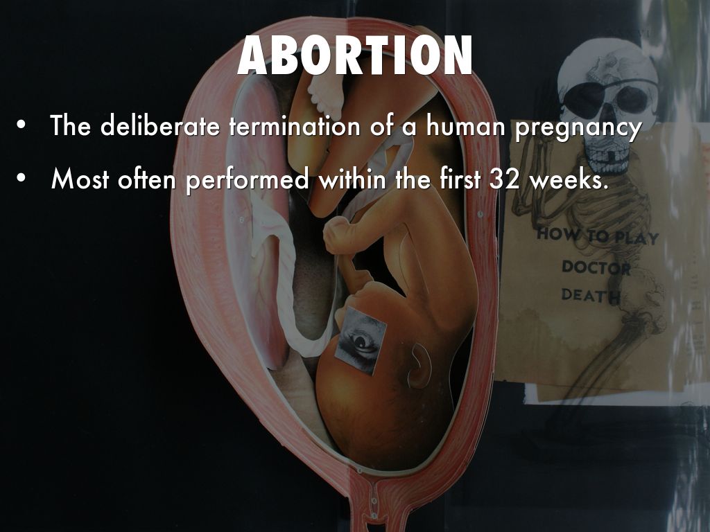 Copy of Abortion by annaorsborn