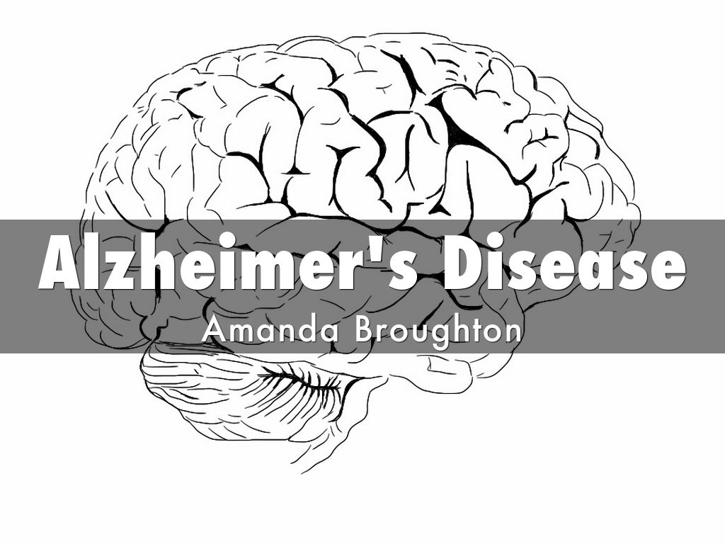 Alzheimer's Disease