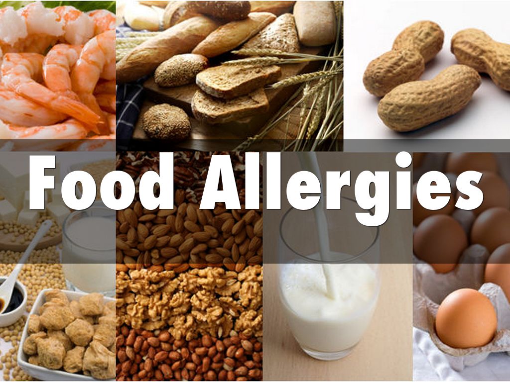 Food Allergies