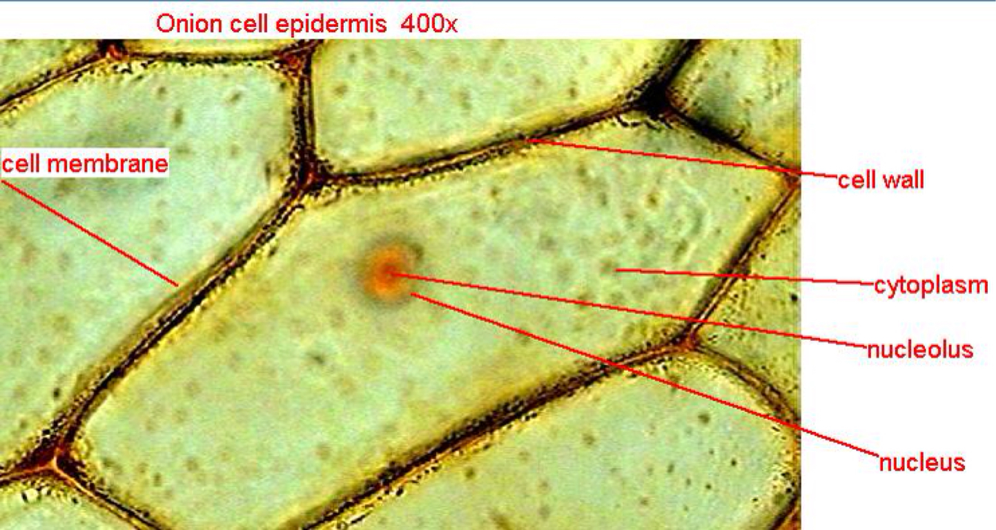 Onion Skin Under Microscope 40X At Jennifer Dermody Blog Onion Skin Under Microscope 40X At Jennifer Dermody Blog