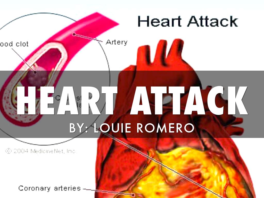 Attacks Of The Heart By Louie Romero