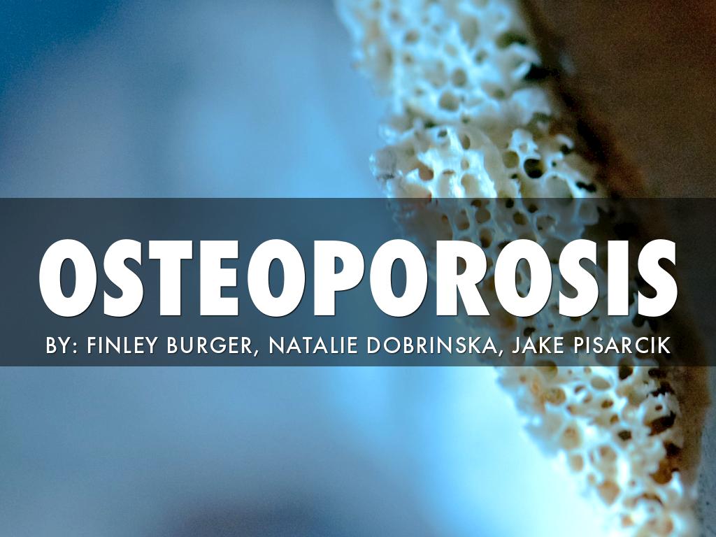 Osteoporosis
