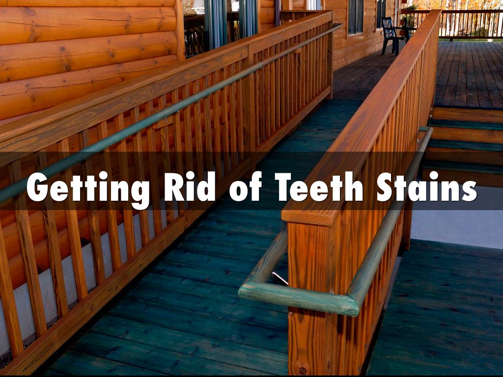 Getting Rid of Teeth Stains 
