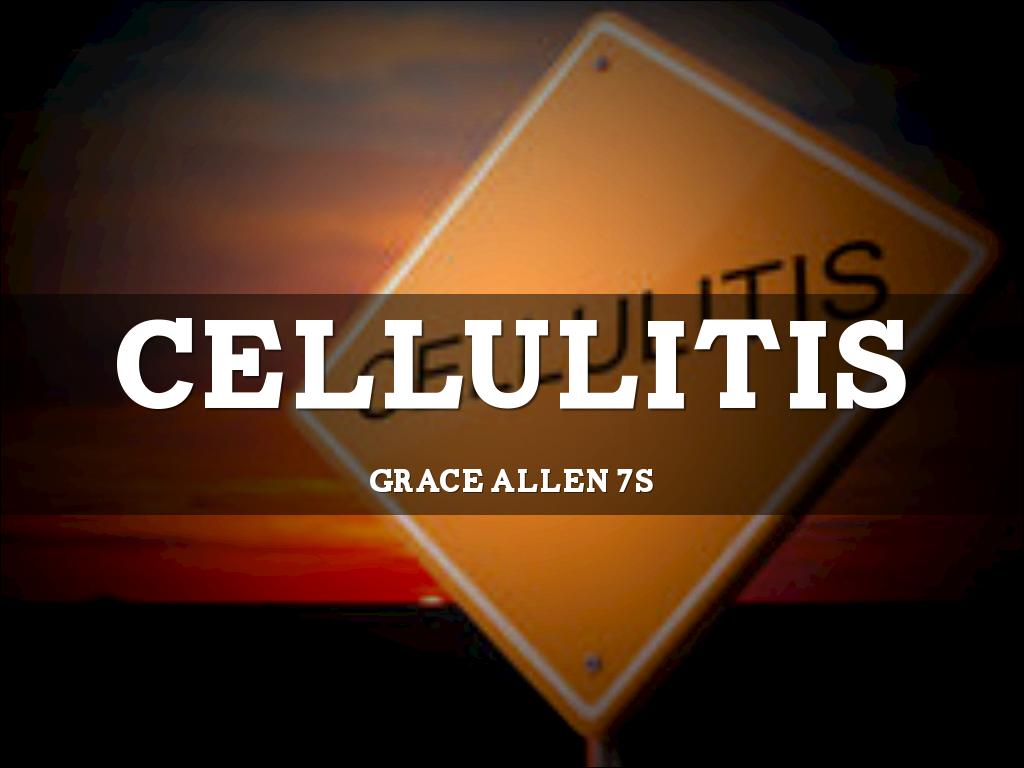 Cellulitis 