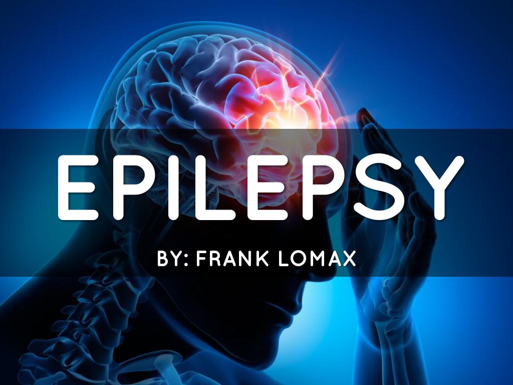 Epilepsy Project