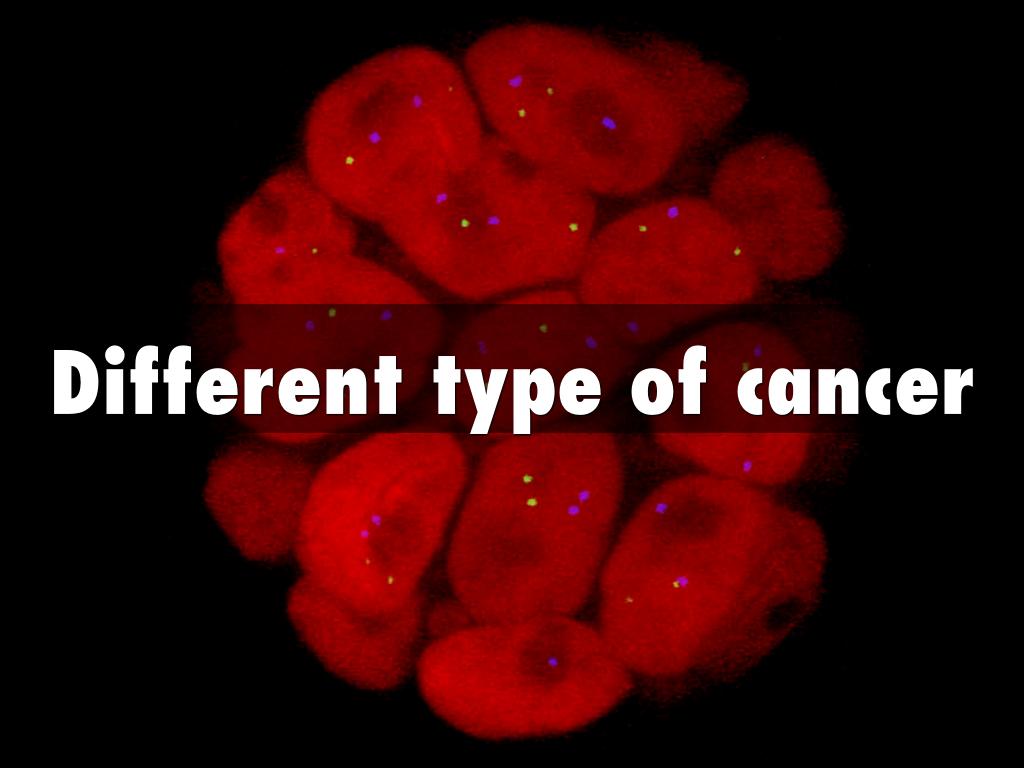 Different type of cancer