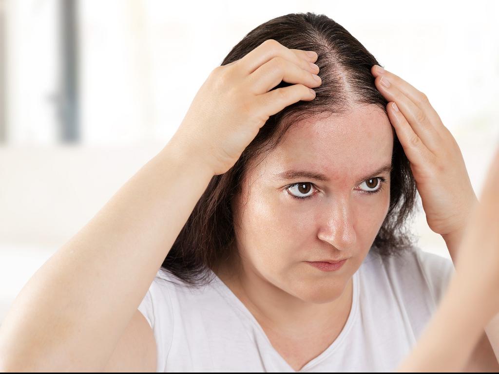 What Causes Mounjaro Users to Lose Hair?