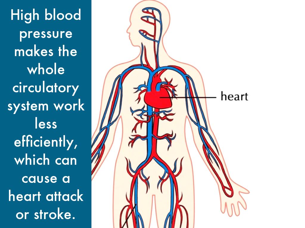 high blood pressure by Gracie B.