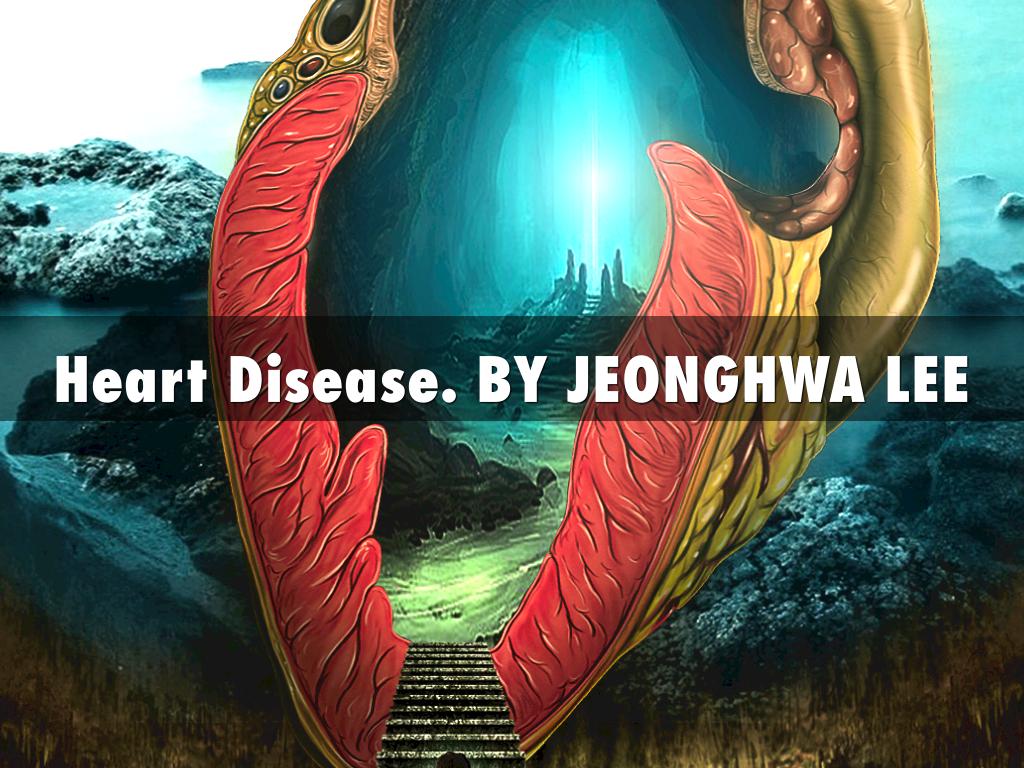 Heart Disease Jeonghwa
