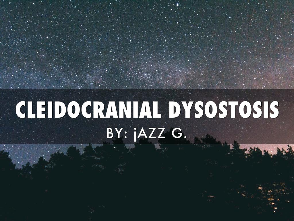Cleidocranial Dysostosis