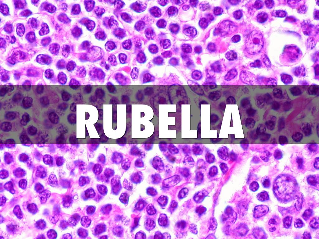 Rubella