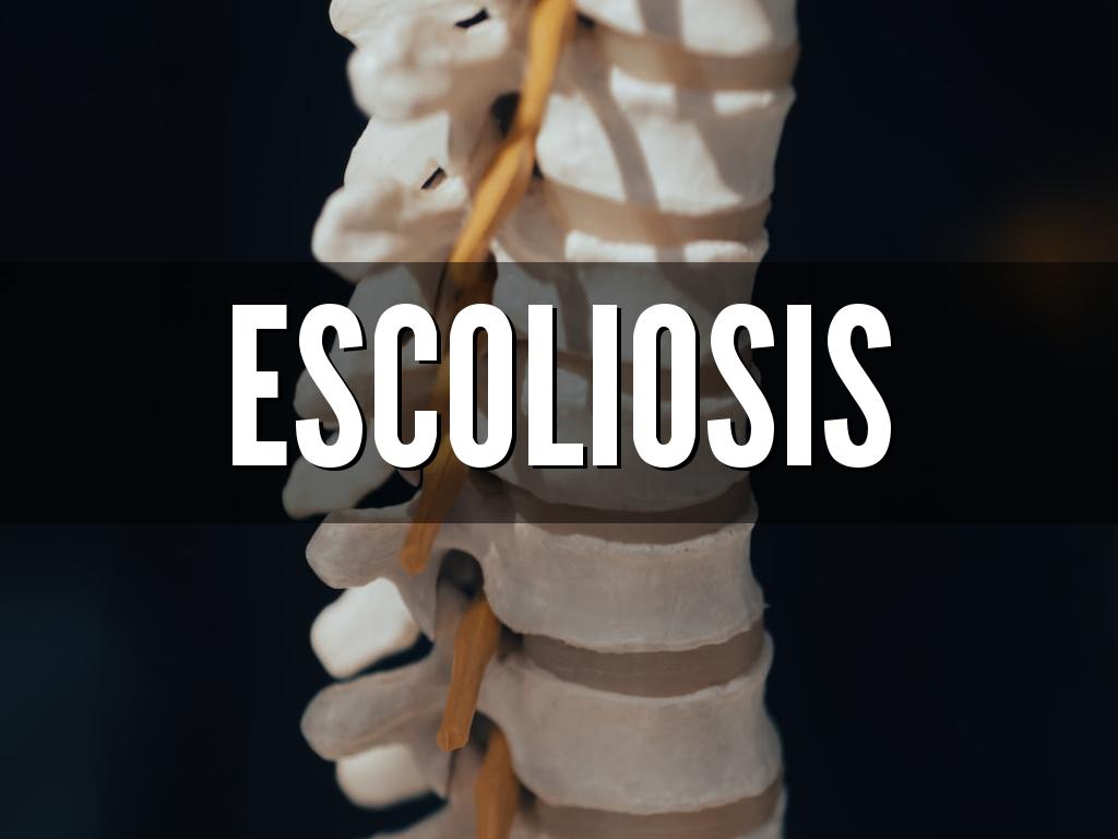 ESCOLIOSIS
