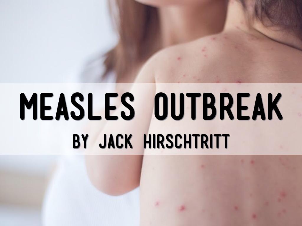 Measles Outbreak
