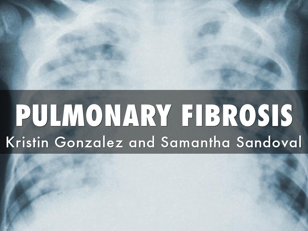 Pulmonary Fibrosis 