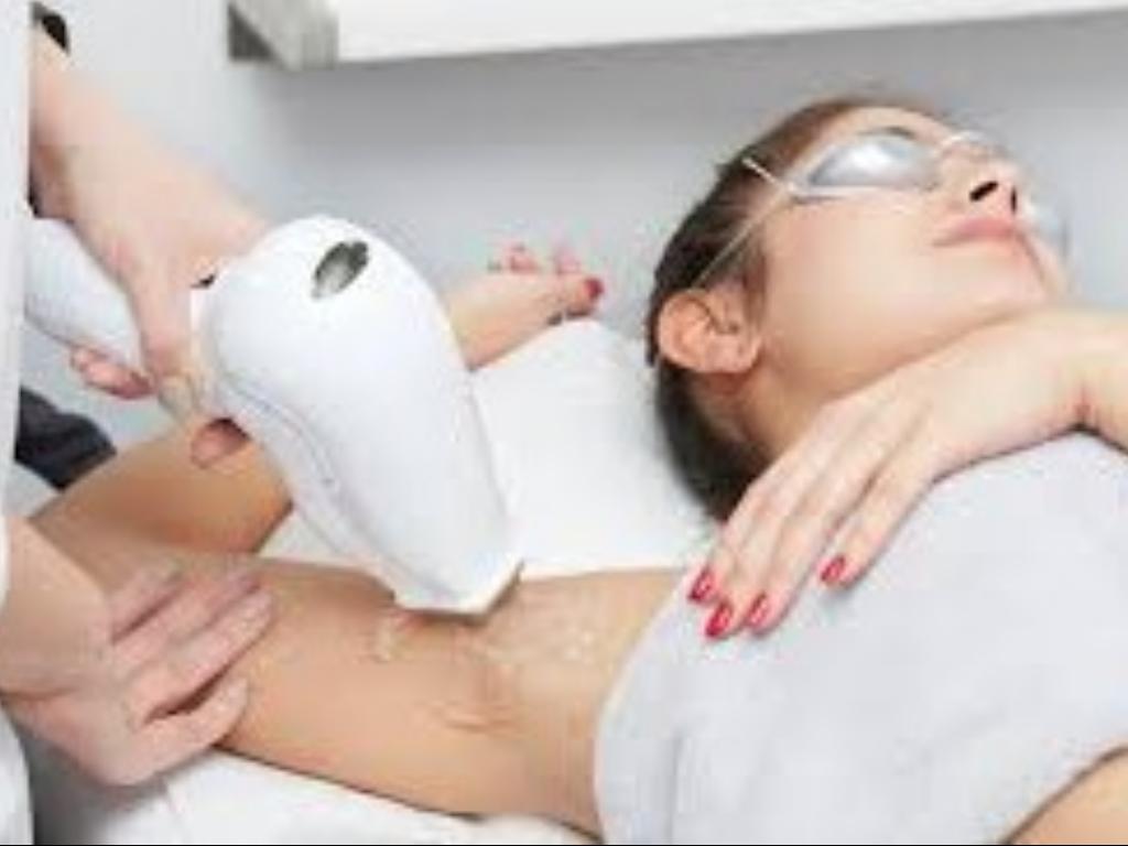 laser hair removal