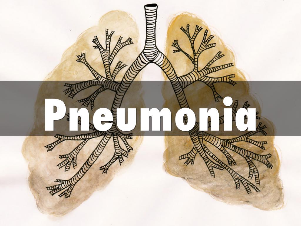 Pneumonia