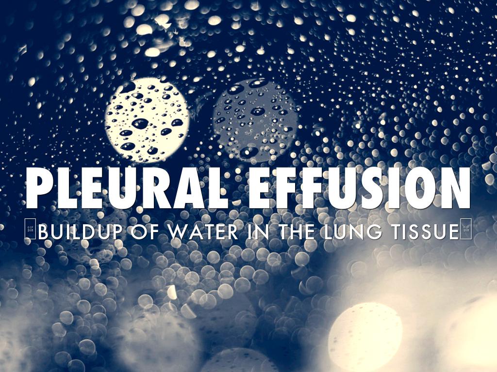 Pleural Effusion