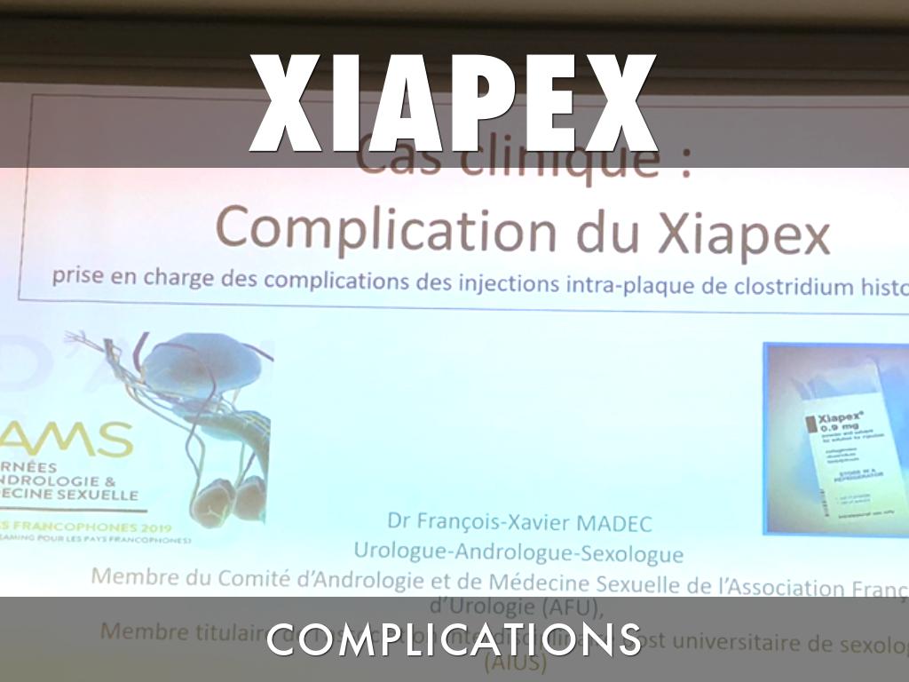 Xiapex Injection #EJAMS2019 by Vincent Hupertan